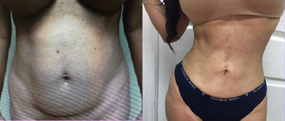 before and after image