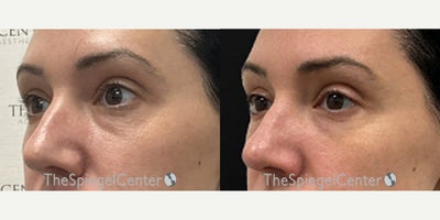 before and after image