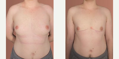 before and after image