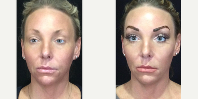 Microblading before and after photo