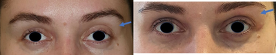 before and after image
