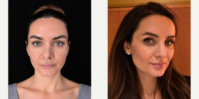 before and after image
