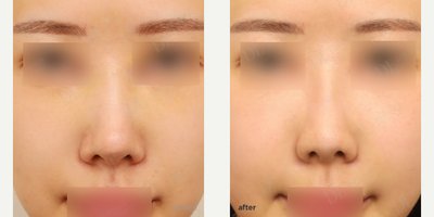 before and after image