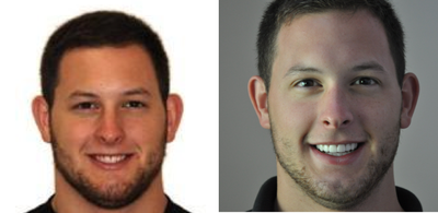Smile Makeover before and after photo