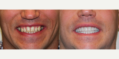 before and after image