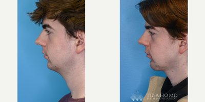 before and after image