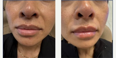 before and after image
