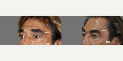 before and after image