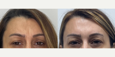 before and after image