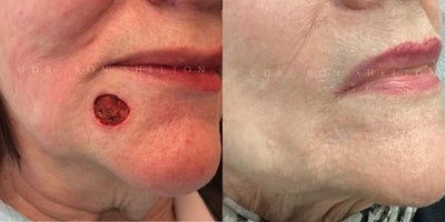 before and after image