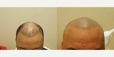 before and after image