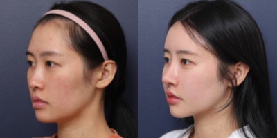before and after image