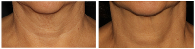 before and after image