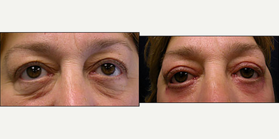 before and after image