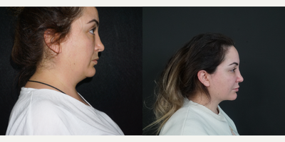 before and after image