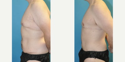 before and after image