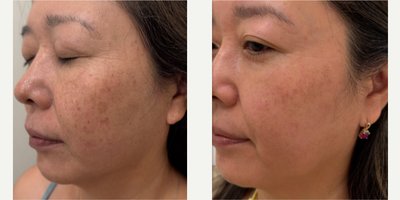 before and after image