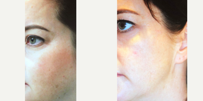 before and after image
