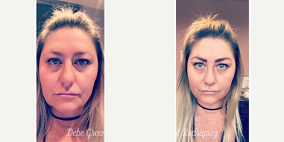 before and after image