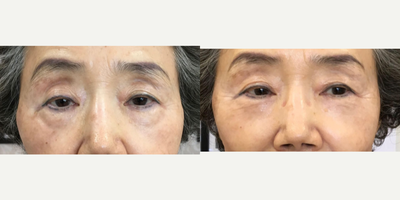 before and after image