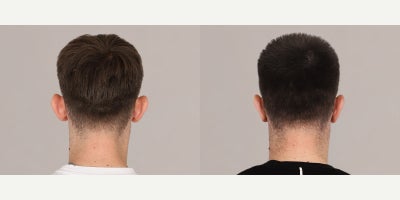 before and after image