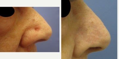 before and after image