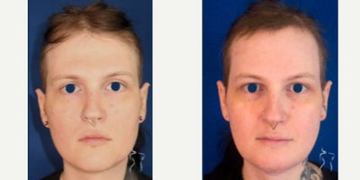 before and after image