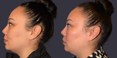 before and after image