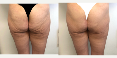 before and after image