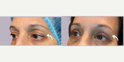 before and after image