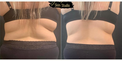 Evolve before and after photo