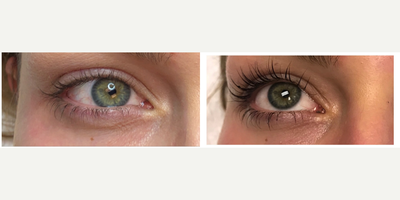 Lash Lift before and after photo