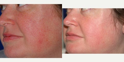 before and after image