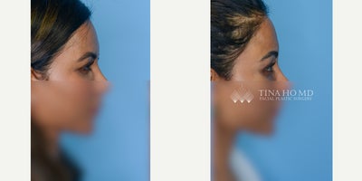 before and after image