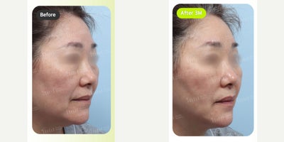 before and after image