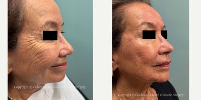 before and after image
