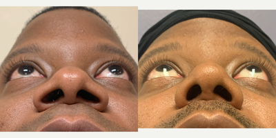 before and after image