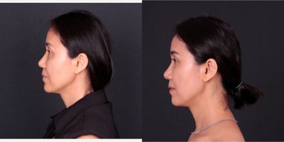 before and after image