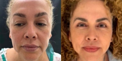 before and after image