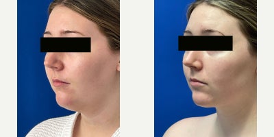 before and after image