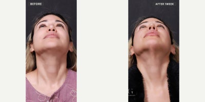 before and after image