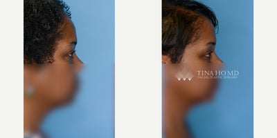 before and after image