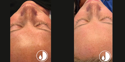 before and after image