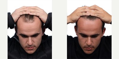 before and after image