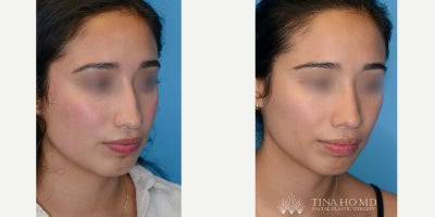 before and after image