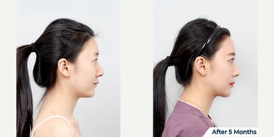 before and after image