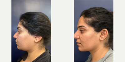 before and after image