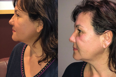 before and after image