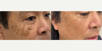 before and after image
