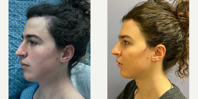 before and after image